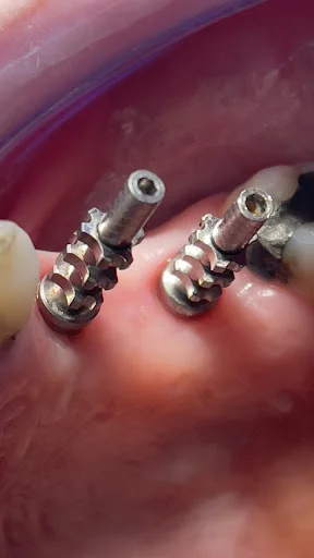 دندانپزشکی دکتر فتح اله عباسپور