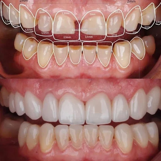 دندانپزشکی زیبایی دکتر رضاعی