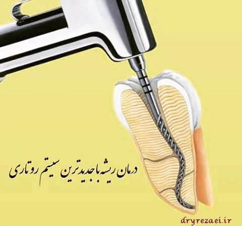 دندانپزشکی زیبایی دکتر رضاعی
