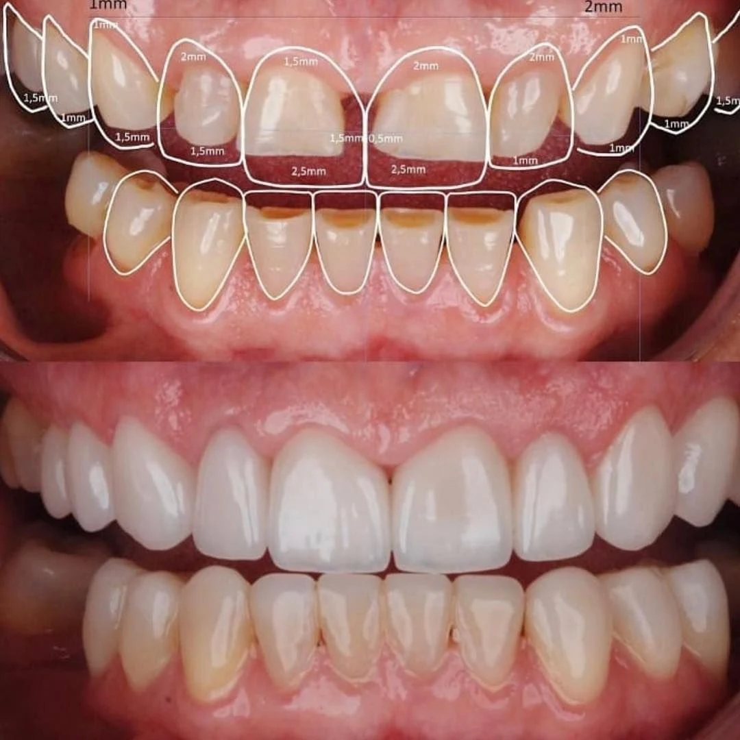 دندانپزشکی زیبایی دکتر یاشار رضاعی