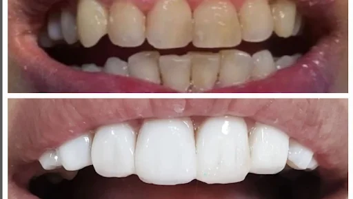 جراح دندانپزشک فلوشیپ ایمپلنت دکتر پرویز حسین علی زاده