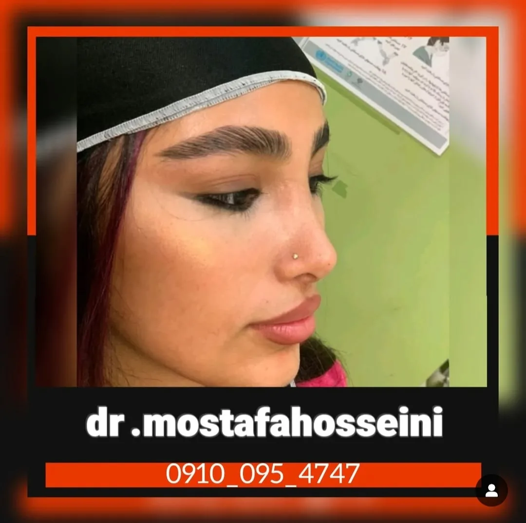 جراحی تخصصی بینی  گوشتی استخوانی - تصویر 4
