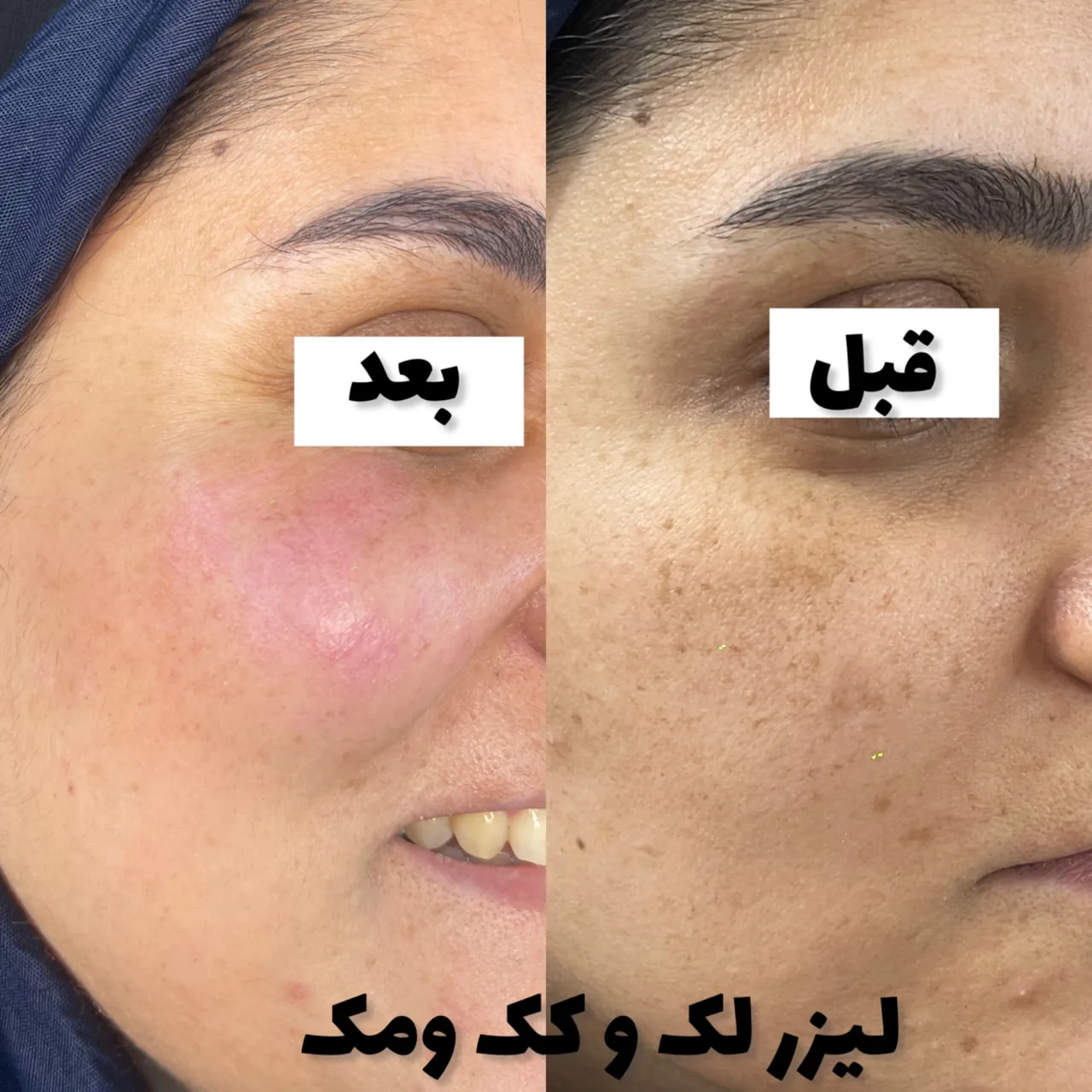 کلینیک زیبایی کهربا - کلینیک پوست و زیبایی در تهران - تصویر 4