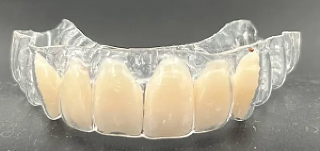 لابراتوار ارتودنسی (آنتی اسنور برای خواب) حبیبی