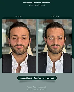 کلینیک زیبایی یوتوپیا