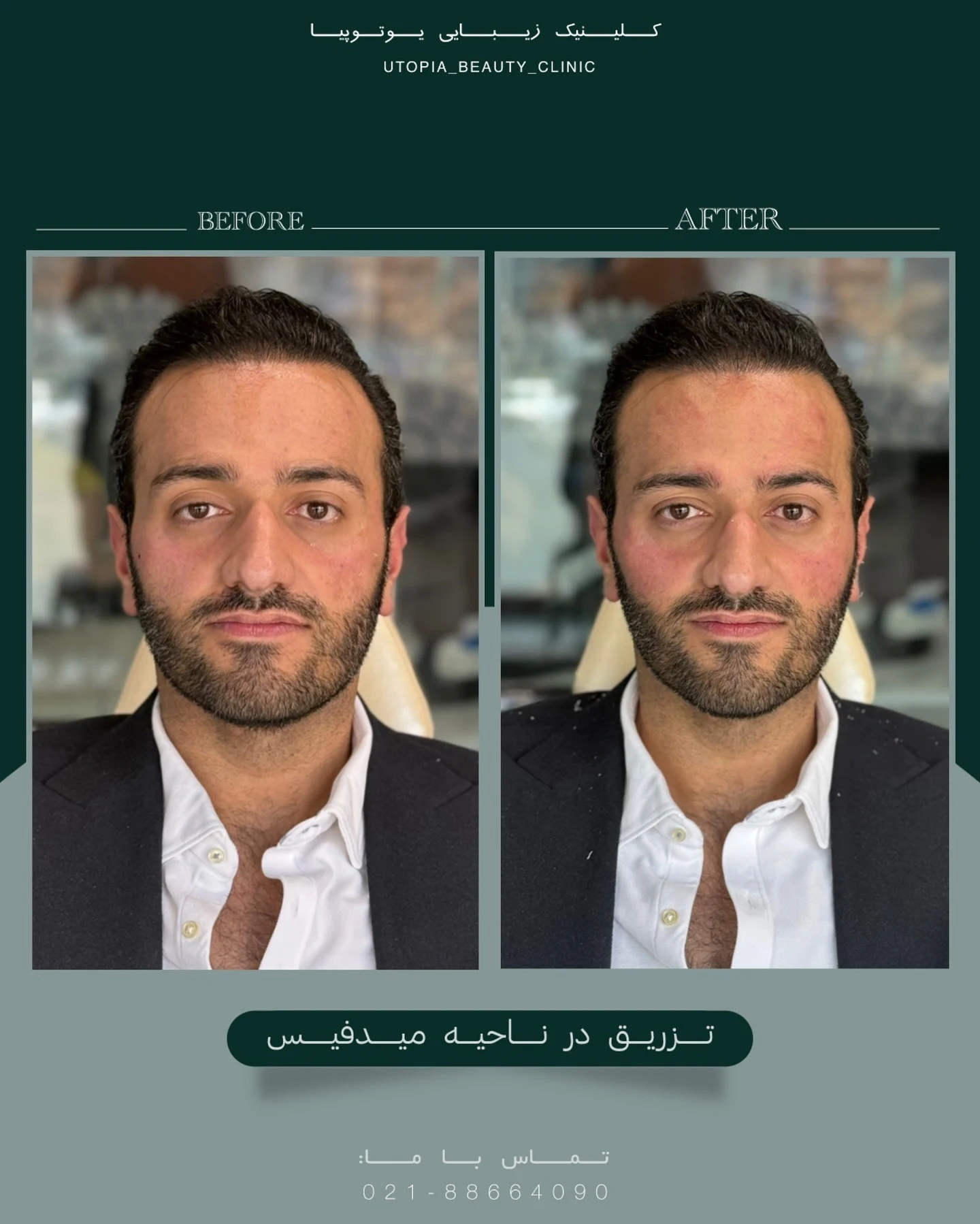 کلینیک زیبایی یوتوپیا