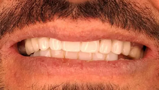 دندانسازی صباغ