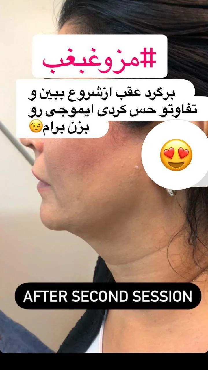 کلینیک زیبایی آیشن - تصویر 5