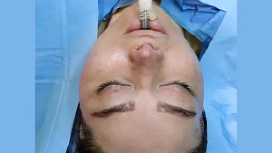 جراحی ویکتوریا صورت سینه شکم