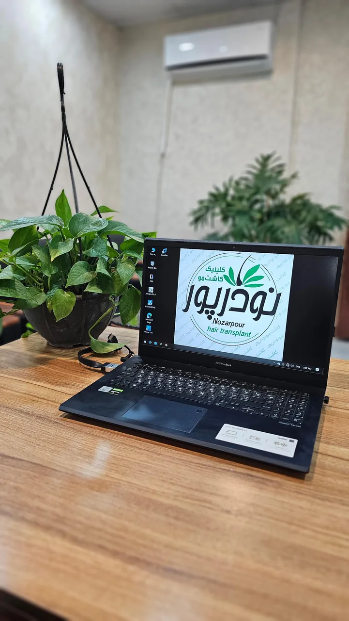 کاشت مو نوذرپور - تصویر 2