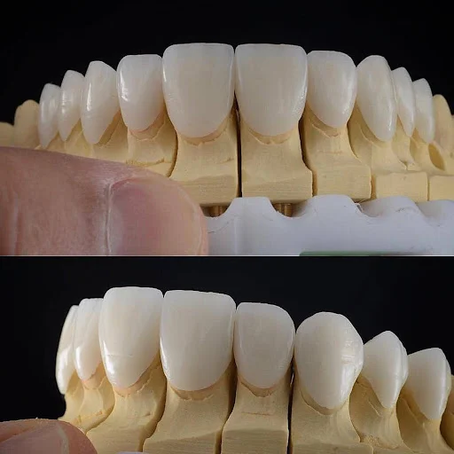 دندانپزشکی دکتر مریم اسماعیل زاده