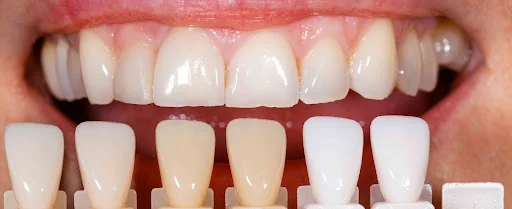 دندانپزشکی دکتر مریم اسماعیل زاده