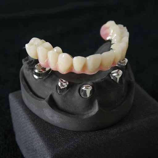 دندانپزشکی دکتر مریم اسماعیل زاده