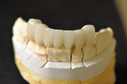 دندانپزشکی دکتر مریم اسماعیل زاده