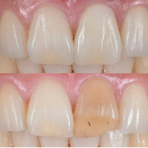 دندانپزشکی دکتر مریم اسماعیل زاده