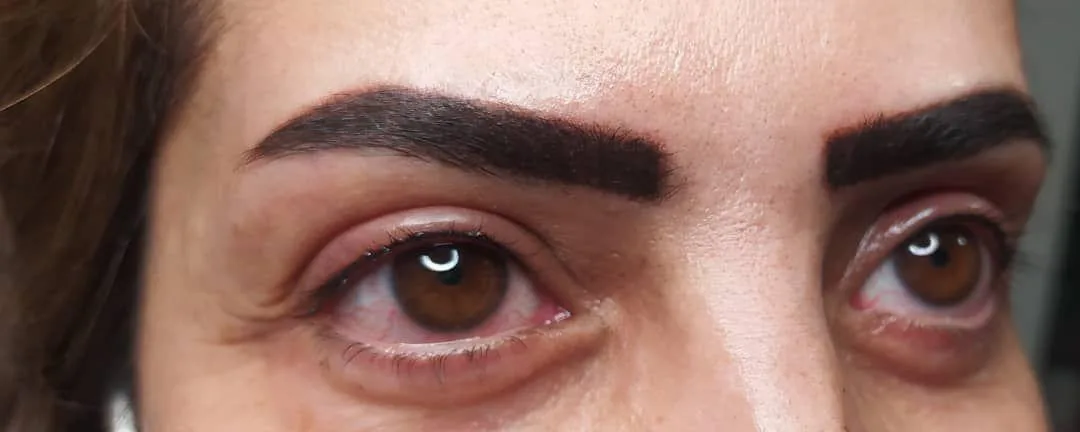 خدمات حرفه ای میکروپیگمنتیشن - تصویر 4
