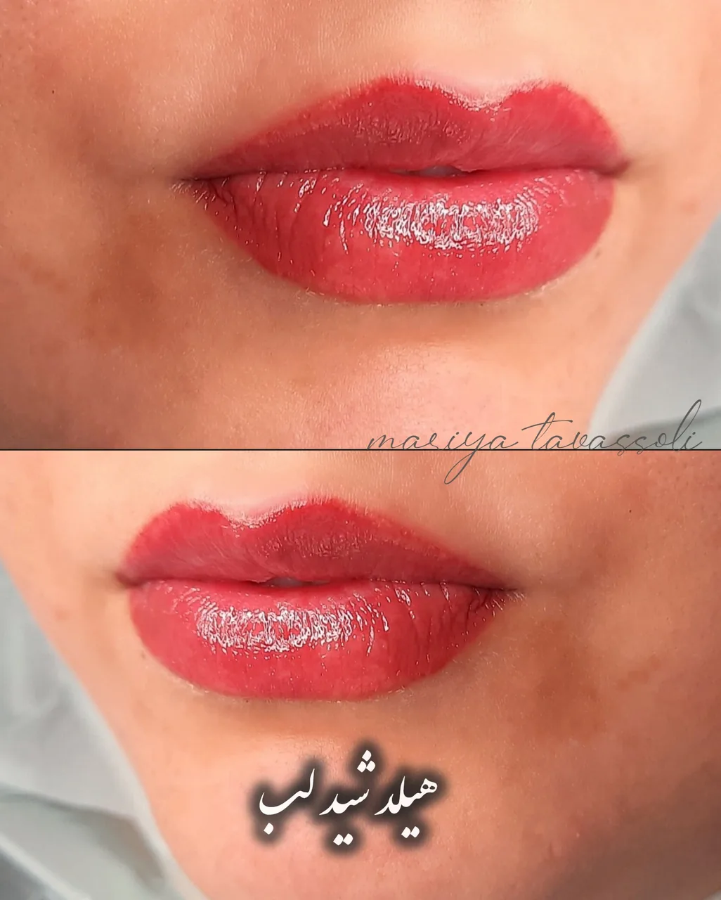 خدمات فوق تخصصی ریموو، شِید لب، بُن مژه - تصویر 2