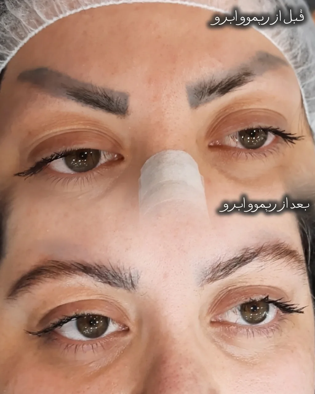 خدمات فوق تخصصی ریموو، شِید لب، بُن مژه - تصویر 4