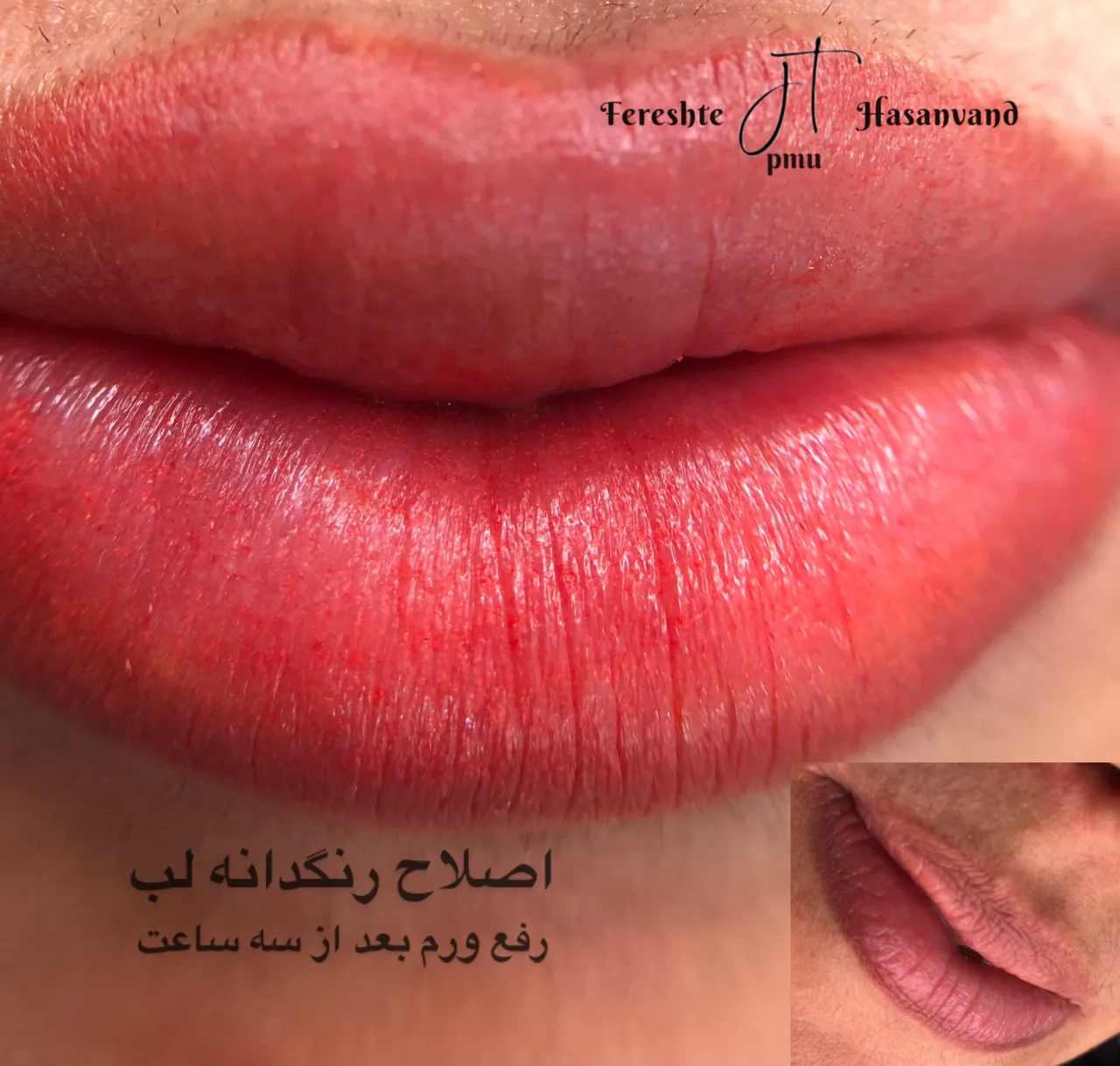 میکروبلیدینگ و خدمات تتو فرشته حسنوند - تصویر 5