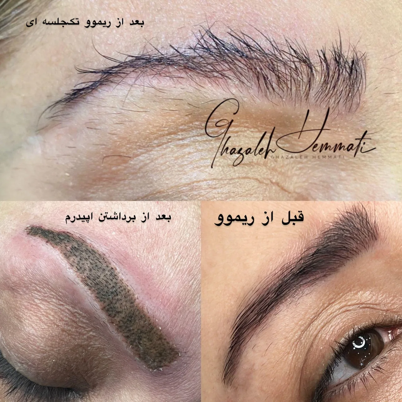 آموزش و خدمات آرایش دائم صورت غزاله همتی - تصویر 4
