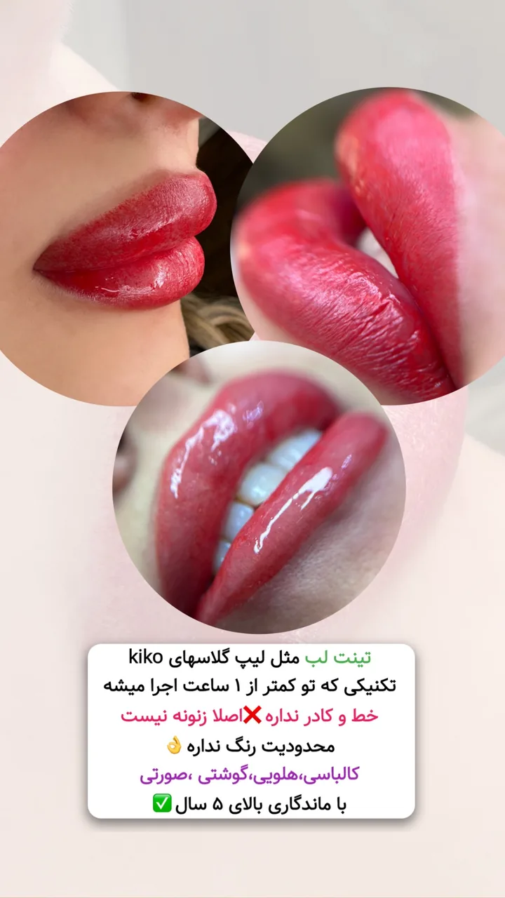 خدمات تخصصی آرایش دائم مریم پوراحمدی - کلینیک پوست و زیبایی در تهران - تصویر 3