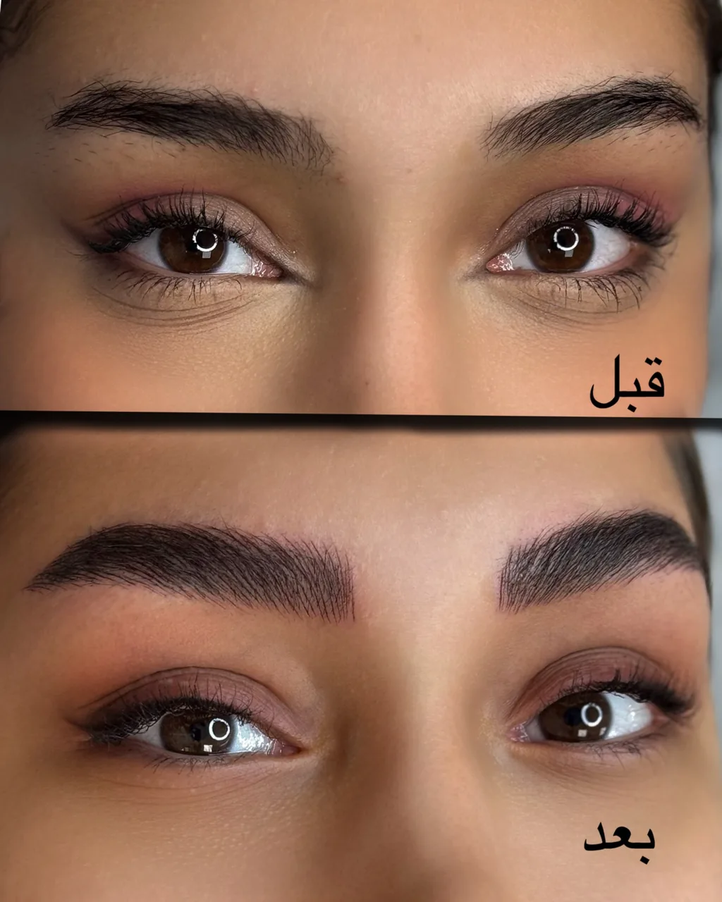 خدمات تخصصی آرایش دائم مریم پوراحمدی - کلینیک پوست و زیبایی در تهران - تصویر 5
