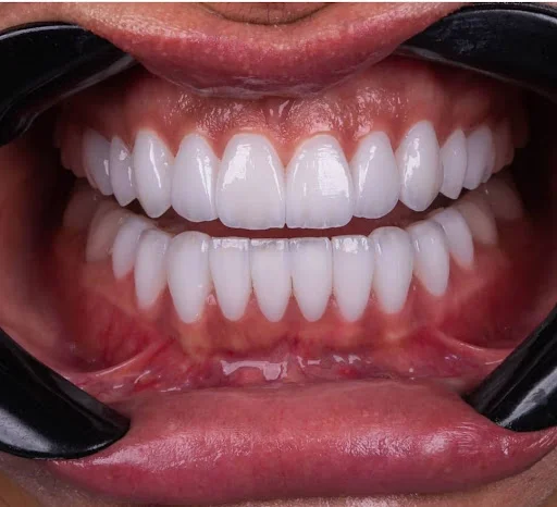 دندانپزشکی دنت پلاس