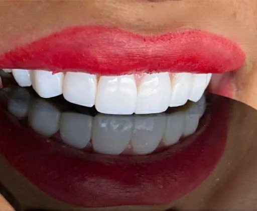 دندانپزشکی دنت پلاس