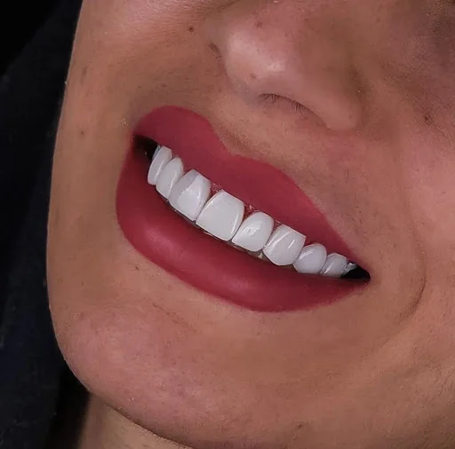 دندانپزشکی دنت پلاس