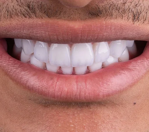 دندانپزشکی دنت پلاس