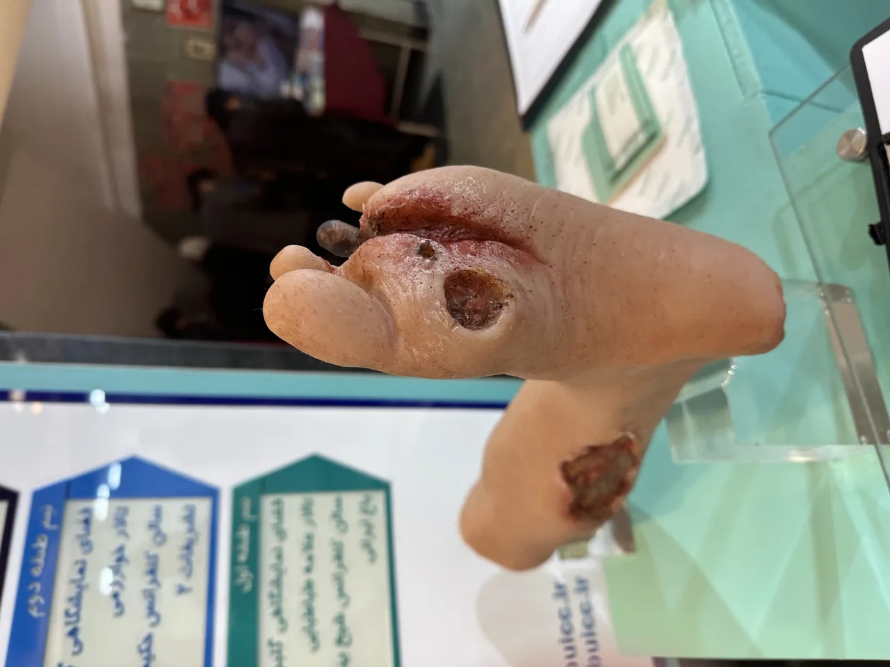 خدمات پرستاری و درمان درمانگستر (درمنزل) - تصویر 3