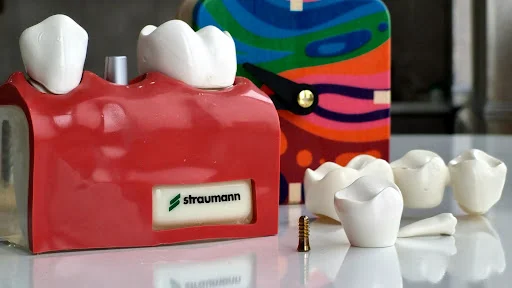 مرکز تخصصی ایمپلنت تبریز