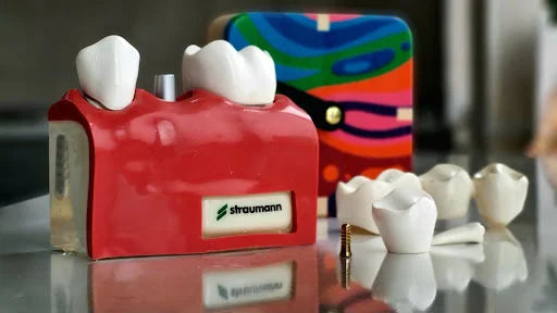 مرکز تخصصی ایمپلنت تبریز