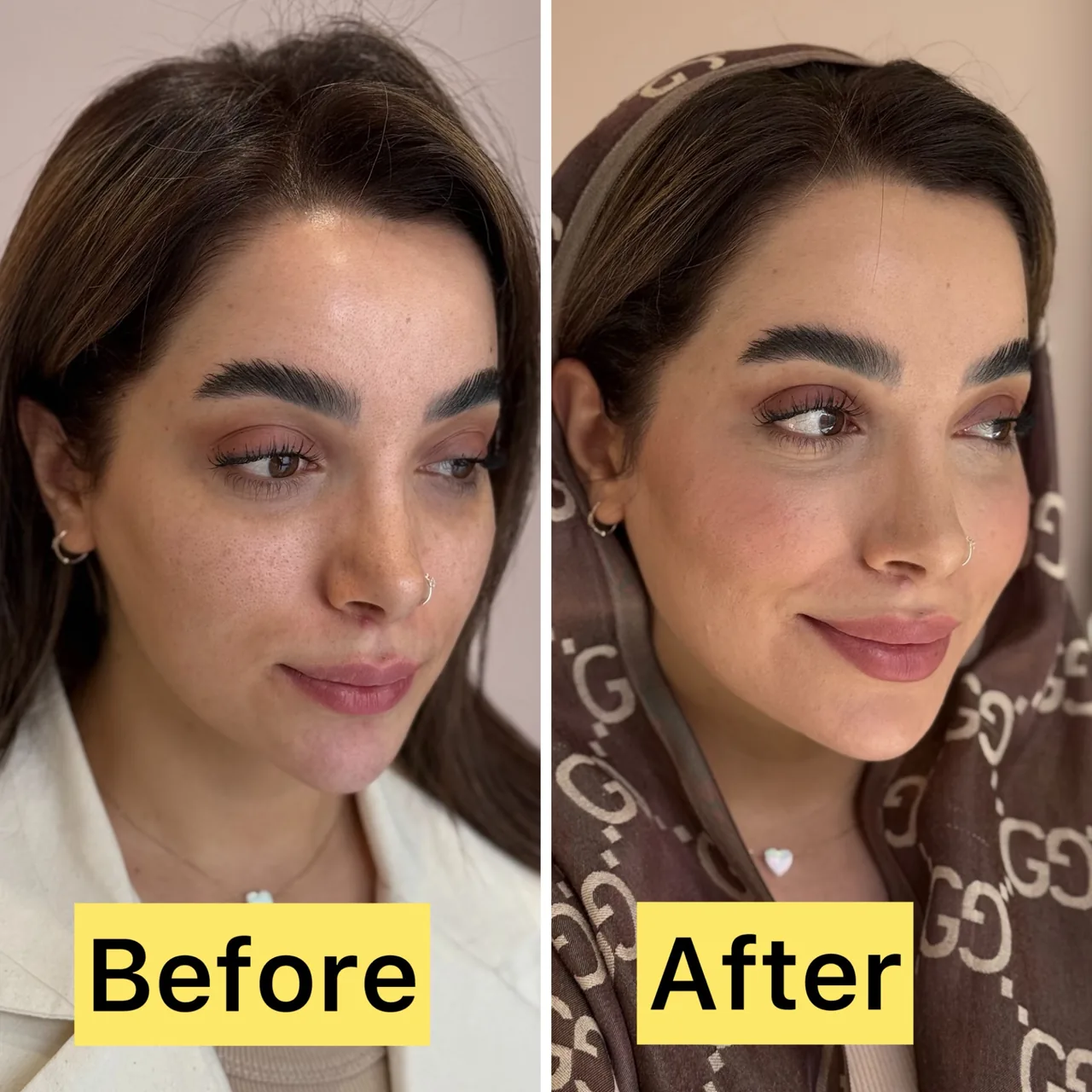 کلینیک زیبایی  و لاغری تخصصی میرای - تصویر 4