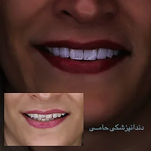 دندانپزشکی حامی (طرف قراردادبیمه نیستیم)