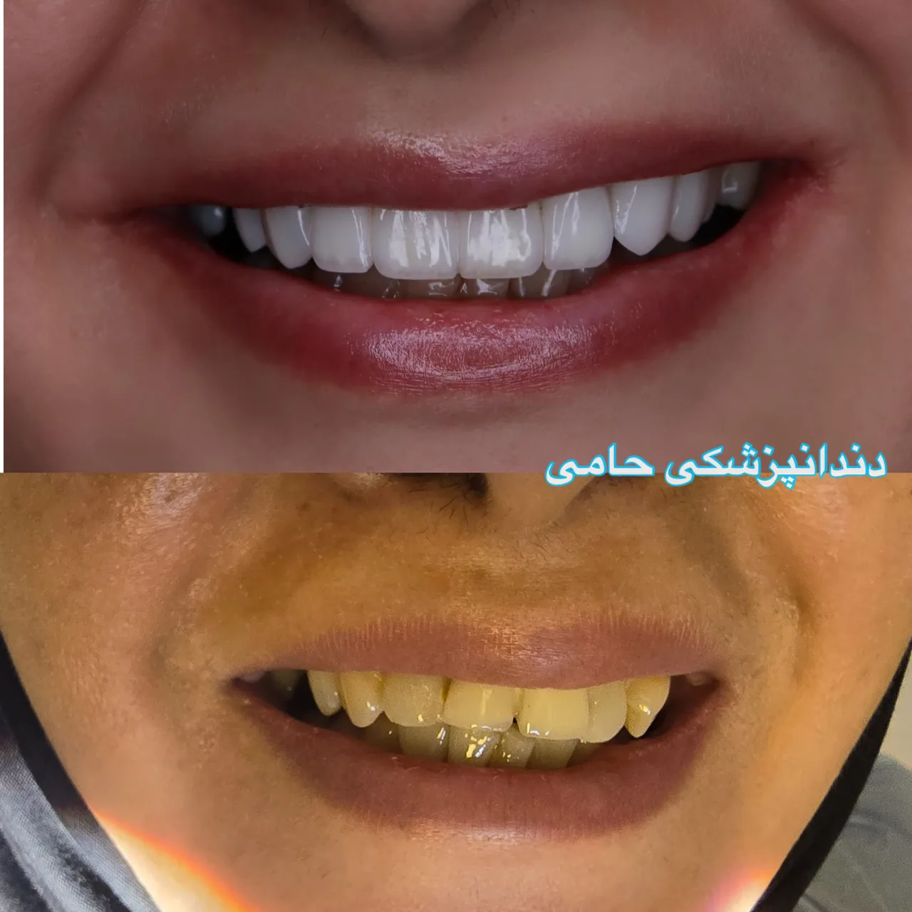 دندانپزشکی حامی (طرف قراردادبیمه نیستیم) - تصویر 2