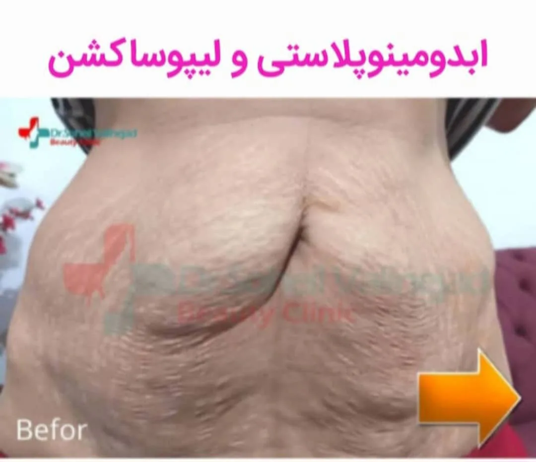 کلینیک زیبایی دکترولی نژاد - تصویر 4