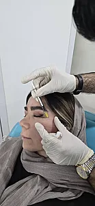 کلینیک زیبایی و لیزر مو  گندم