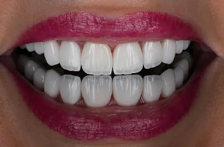کلینیک تخصصی دندانپزشکی آلفا(بیمه داریم)