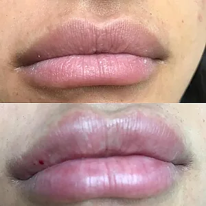 کلینیک بوتاکس ژل و لیزر سعادت اباد