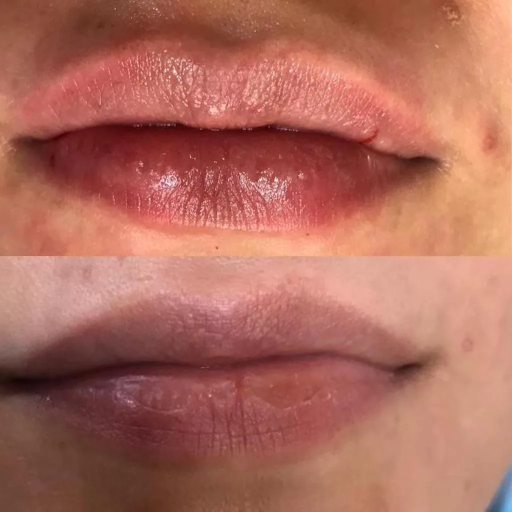 کلینیک بوتاکس ژل و لیزر سعادت اباد - تصویر 2
