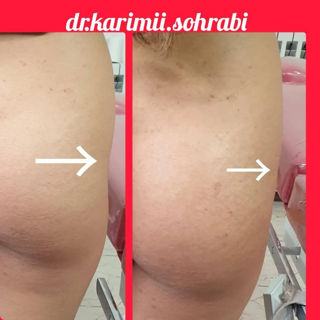 مرکز تزریق چربی و لیزر بدن شمس آباد - تصویر 2