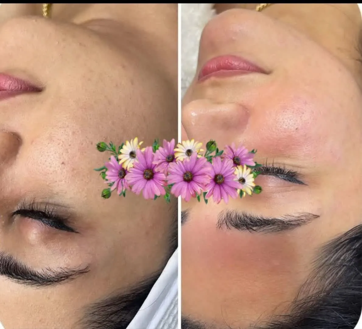 پاکسازی و فیشال لی لی - تصویر 3