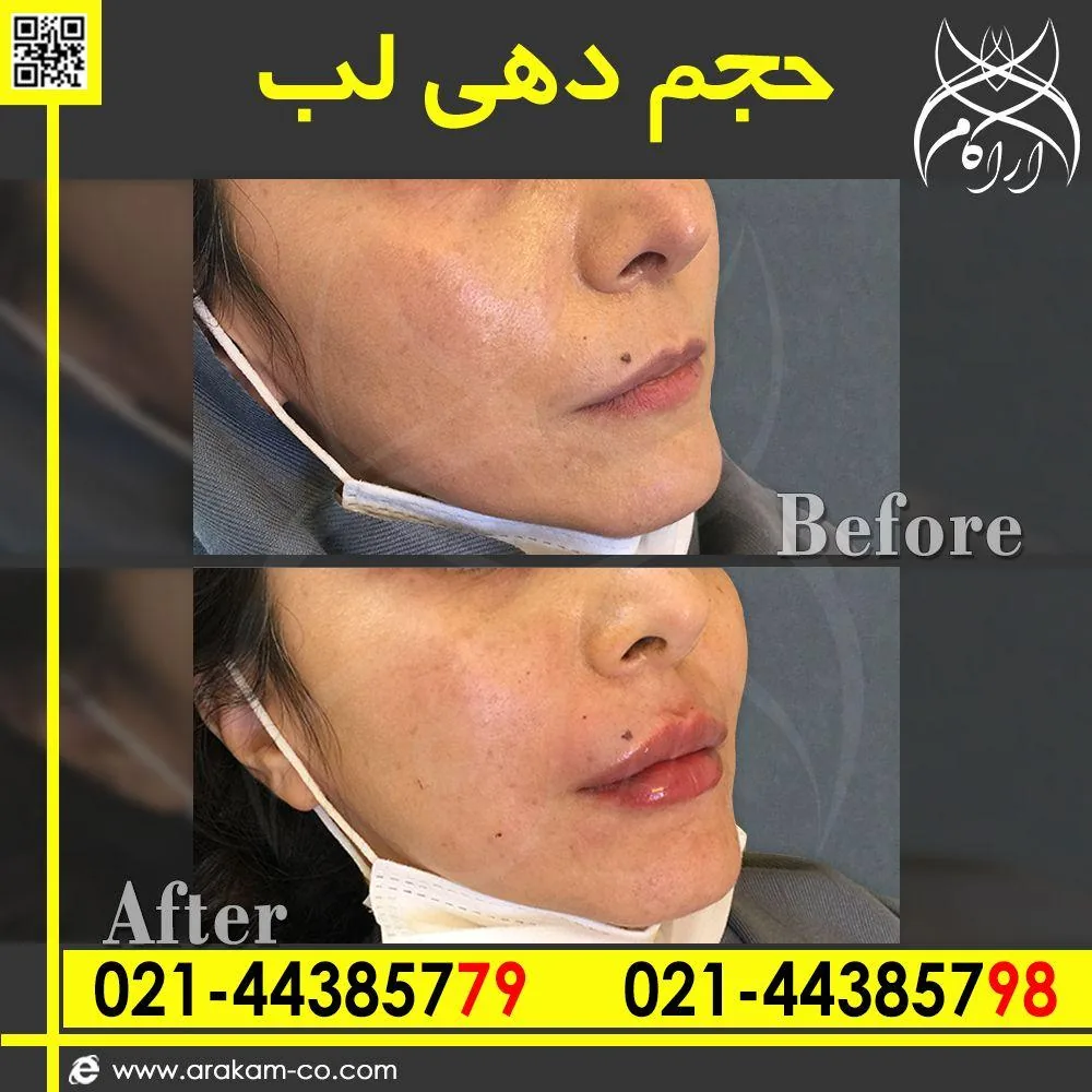کلینیک پوست و لیزر آراکام
