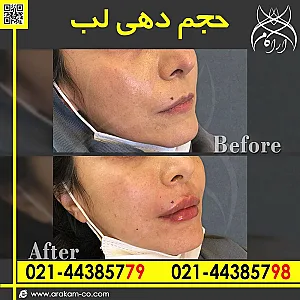 کلینیک پوست و لیزر آراکام