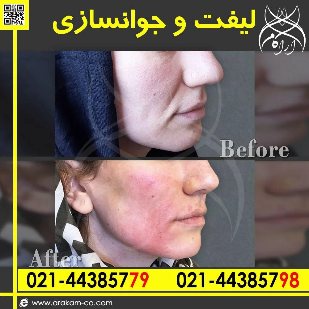 کلینیک پوست و لیزر آراکام - تصویر 3