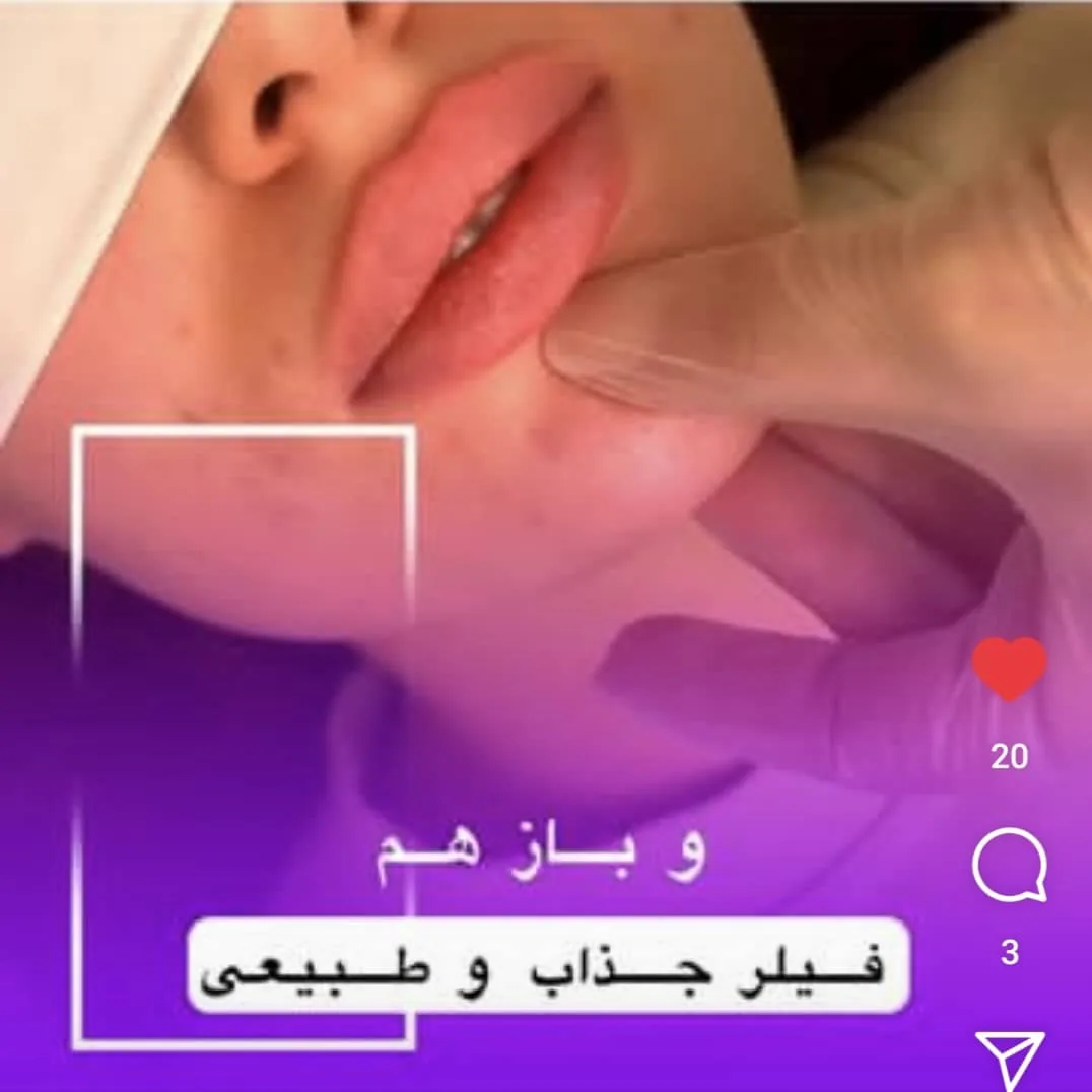کلینیک زیبایی و پوست و مو ماه میس - تصویر 3