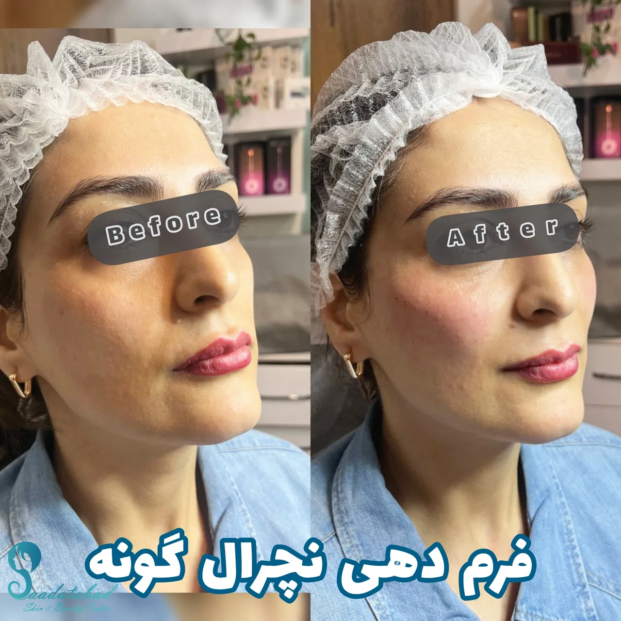 مرکز تخصصی لیزر و زیبایی سعادت آباد - تصویر 2