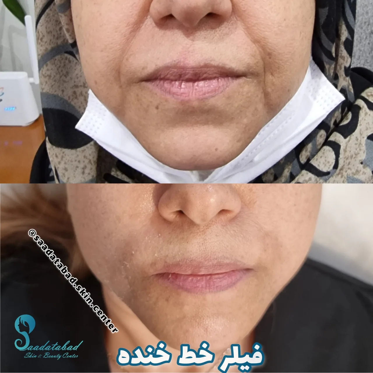 مرکز تخصصی لیزر و زیبایی سعادت آباد - تصویر 4
