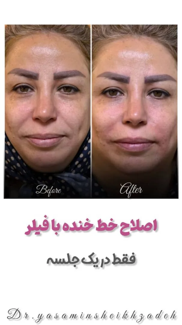 کلینیک پوست مو زیبایی و لیزر کیمیا